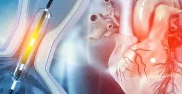 Cardiac Catheterisation (1)