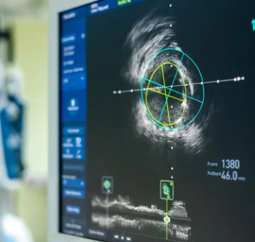 Intravascular Imaging